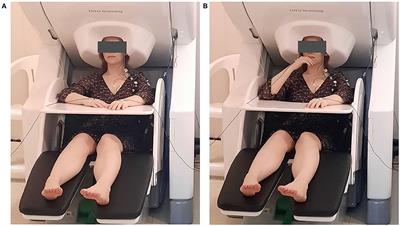 Feasibility and Challenges of Performing Magnetoencephalography Experiments in Children With Arthrogryposis Multiplex Congenita